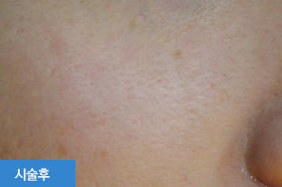 ���Ǵ�Ʈ �Ļ���