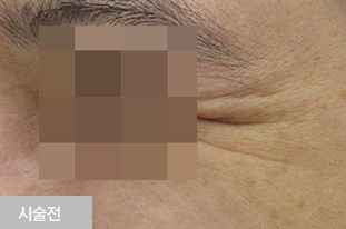 �������彺 ������