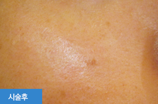 ¾ÆÄí¾ÆÇÊ Àü »çÁø